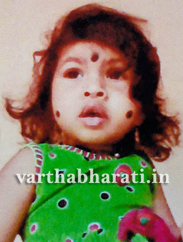 ಮಗುವಿಗೆ ಅಪರೂಪದ ಕಾಯಿಲೆ: ಚಿಕಿತ್ಸೆ ನೆರವಿಗೆ ಮನವಿ